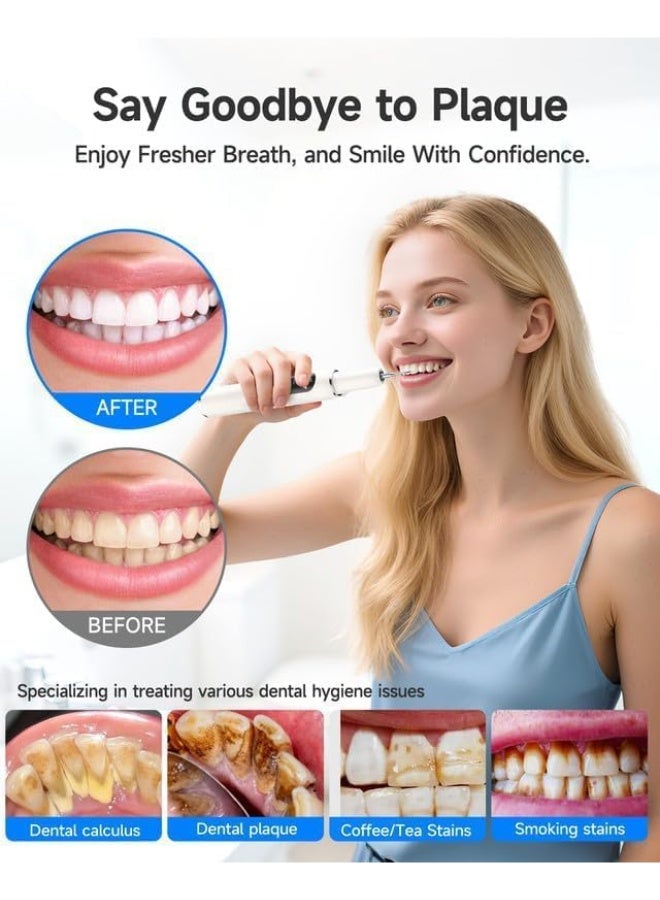 7000 Plaque Remover for Teeth, Tartar Remover for Teeth, Dental Calculus Remover, Teeth Cleaning Kit 5 Speed Modes with 3 Replaceable Heads, with LED Light. - Image 2