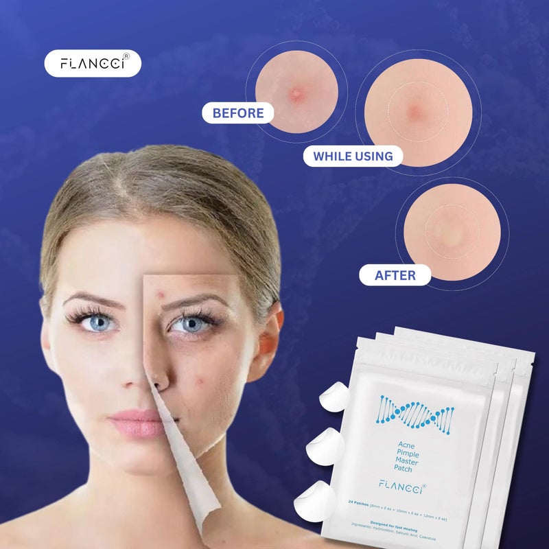 FLANCCI Pimple Patch Acne Patches Facial Skin Care Products, Blackhead Remover Skincare, Pimple Patch for Face and Hydrocolloid Acne Treatment Patch Salicylic Acid, Acne Spot Treatment (24 Count (Pack of 1)) - Image 5
