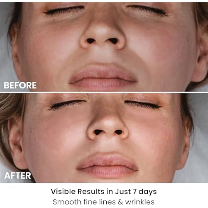 AMIRO قناع الوجه AMIRO Spectra للعلاج بالضوء 5 في 1، مع ضوء أزرق، أحمر، أخضر، أصفر، وأشعة تحت الحمراء، 3 أوضاع للبشرة الدهنية، المعرضة لحب الشباب، والمترهلة، العناية بالبشرة للوجه، فضي - Image 3