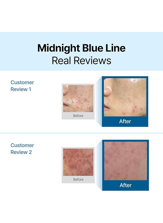 Klairs Midnight Blue Calming Cream, Soothing Redness Relief Moisturizer, for Oily Skin, Sensitive Skin Friendly, 60g - Image 3