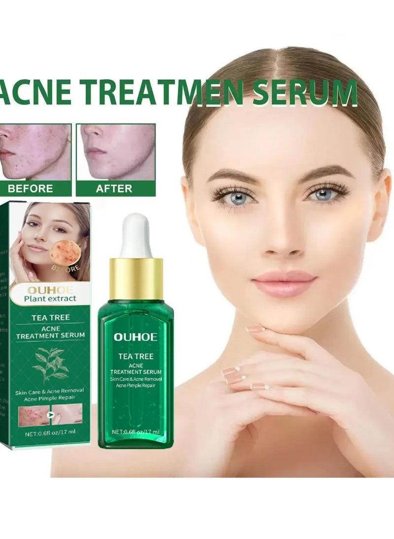 OUHOE - Acne Treatment Serum, Anti Ageing Pore Shrinking Skin Care Essence, Facial Repair Moisturizing Essence, Pimple Spots Remover Tea Tree Serum For Dark Spots Acne Pimples, Green - Image 1