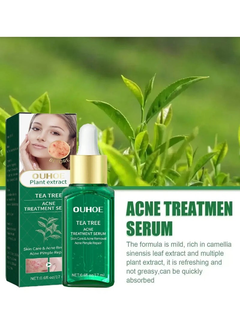 OUHOE - Acne Treatment Serum, Anti Ageing Pore Shrinking Skin Care Essence, Facial Repair Moisturizing Essence, Pimple Spots Remover Tea Tree Serum For Dark Spots Acne Pimples, Green - Image 1