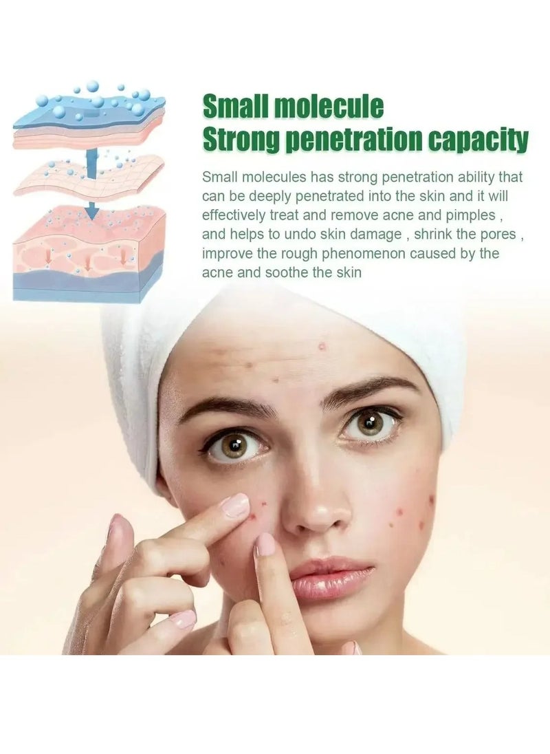 OUHOE - Acne Treatment Serum, Anti Ageing Pore Shrinking Skin Care Essence, Facial Repair Moisturizing Essence, Pimple Spots Remover Tea Tree Serum For Dark Spots Acne Pimples, Green - Image 1