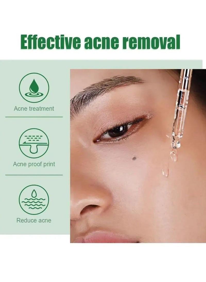 OUHOE - Acne Treatment Serum, Anti Ageing Pore Shrinking Skin Care Essence, Facial Repair Moisturizing Essence, Pimple Spots Remover Tea Tree Serum For Dark Spots Acne Pimples, Green - Image 1