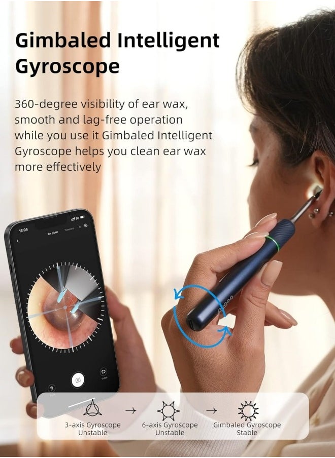 Ear Wax Removal Tool with Camera WiFi Visible Ear Cleaner with Tweezer with 10 Megapixels Gimbaled Gyroscope 12 Ear Spoons Base Storage Household Ear Cleaning Kit for IOS and Android - pzsku/Z6782BECD3758DDB030EDZ/45/_/1701056821/419b7fcd-af07-4fa0-945f-bb349e3e0514