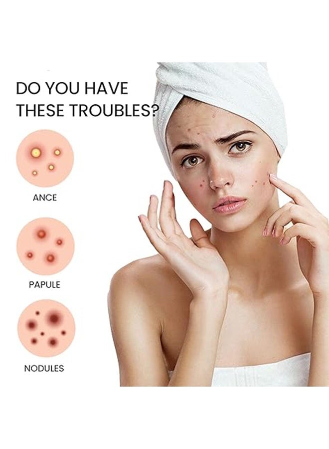 200 PCS Pimple Patches Stars, Hydrocolloid Acne Patches,  Spot Stickers for Face Acne Dots - Image 3