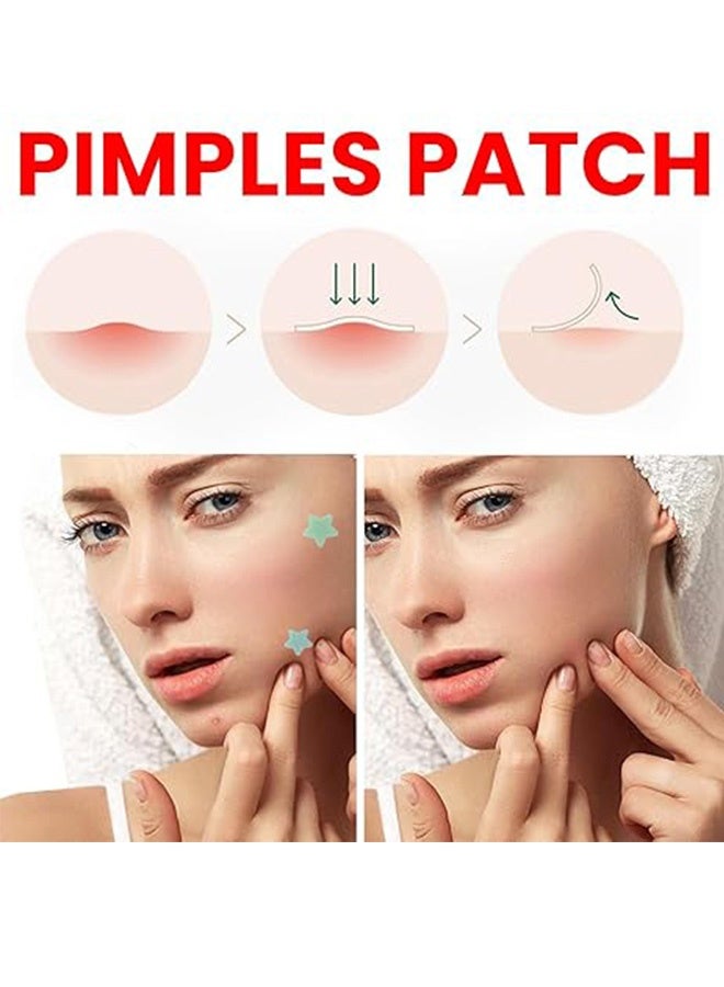 200 PCS Pimple Patches Stars, Hydrocolloid Acne Patches,  Spot Stickers for Face Acne Dots - Image 2