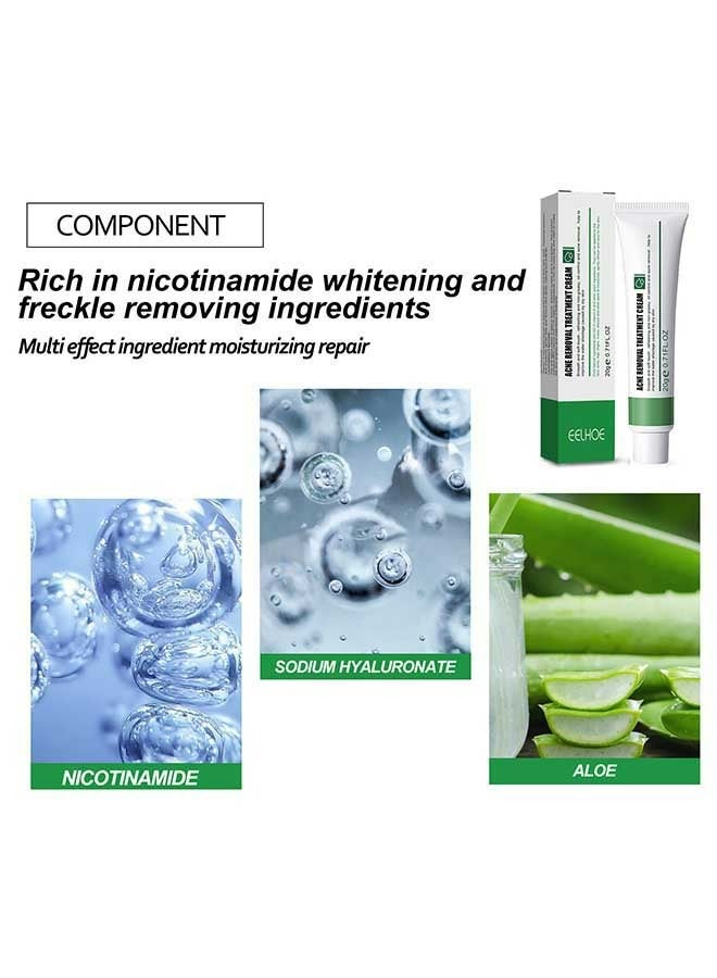 EELHOE Acne Removal Treatment Cream 20g, Quick Acne Removal, Fade Spots, Control Water And Oil Balance, Suitable For Oily And Acne Prone Skin, Oil Control Acne Cream - Image 3