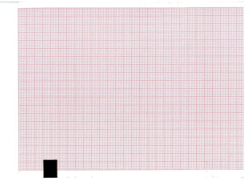 EEG Paper 110MM X 140MM X 142SHEETS (Works for FUKUDA OP-222TE, FX 7202, EDAN SE 601 Series, SE-601A, SE-601, SE-601C, Cardio TECH CRT-6, SE-601B, EDAN SE-3, SPACELABS SL6, Advanced ECG-6) (10)