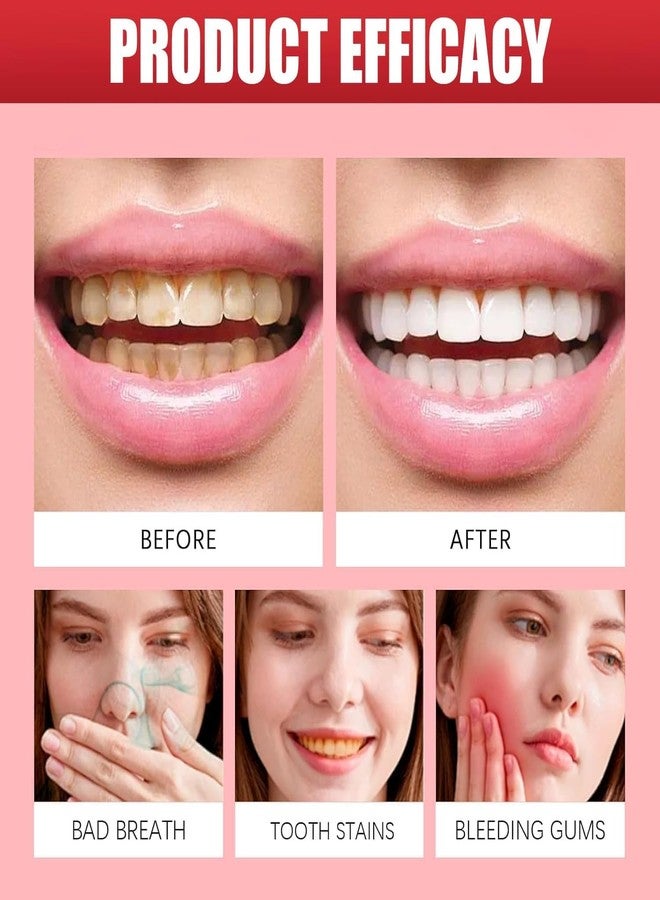 Aiwejay SP10 Probiotic Toothpaste, SP 10 probiotic Toothpaste whitening, Fresh Breath Formula with Probiotics, Deep Cleaning - Image 5