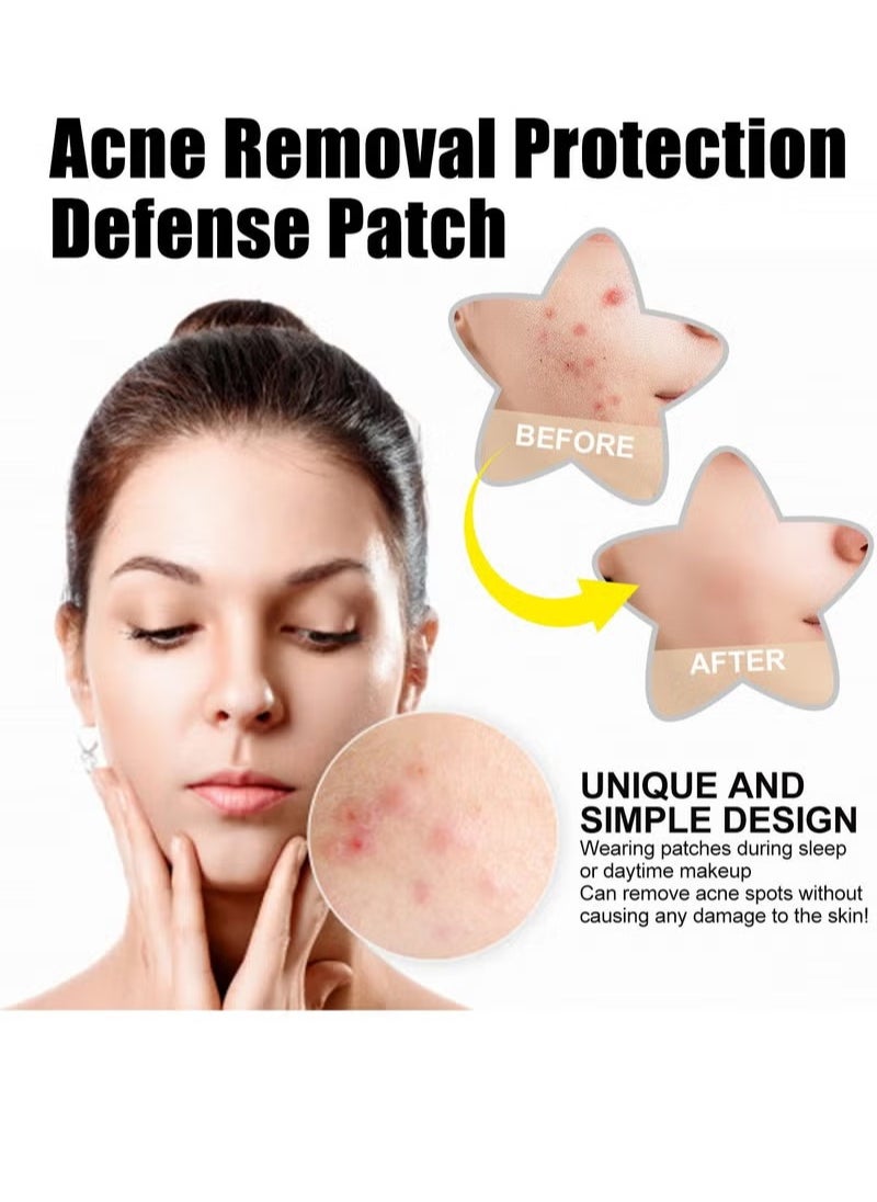 West&Month - 60 PCS Colorful Hydrocolloid Acne Absorbing Pimple Patch - Image 1