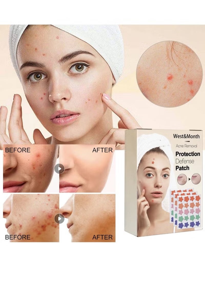 West&Month - 60 PCS Colorful Hydrocolloid Acne Absorbing Pimple Patch - Image 1