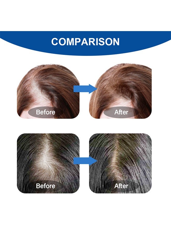 سوميفون مصل نمو الشعر - بخاخ نمو الشعر للعناية بفروة الرأس - بخاخ مصل تركيبة نمو الشعر الفائق ، ينمو شعر أكثر كثافة في 8 أسابيع - 30 مل - Image 5