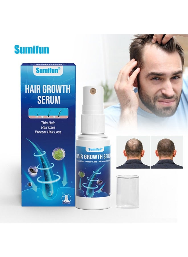 سوميفون مصل نمو الشعر - بخاخ نمو الشعر للعناية بفروة الرأس - بخاخ مصل تركيبة نمو الشعر الفائق ، ينمو شعر أكثر كثافة في 8 أسابيع - 30 مل - Image 1