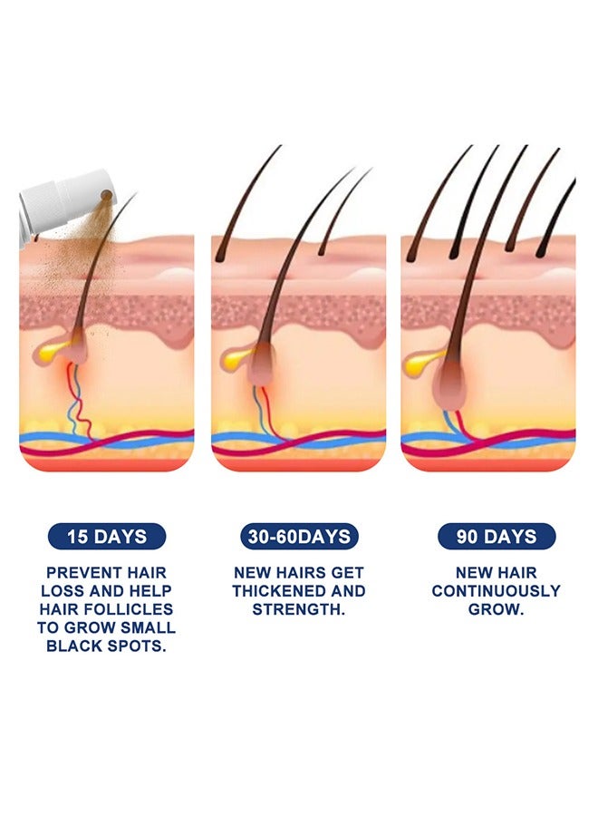 سوميفون مصل نمو الشعر - بخاخ نمو الشعر للعناية بفروة الرأس - بخاخ مصل تركيبة نمو الشعر الفائق ، ينمو شعر أكثر كثافة في 8 أسابيع - 30 مل - Image 3