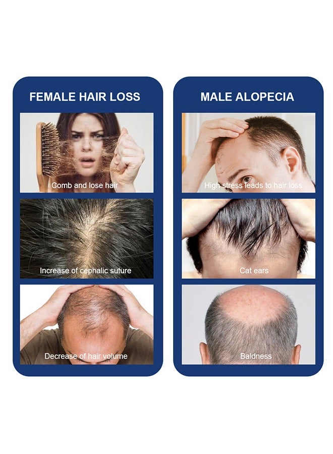 سوميفون مصل نمو الشعر - بخاخ نمو الشعر للعناية بفروة الرأس - بخاخ مصل تركيبة نمو الشعر الفائق ، ينمو شعر أكثر كثافة في 8 أسابيع - 30 مل - Image 4