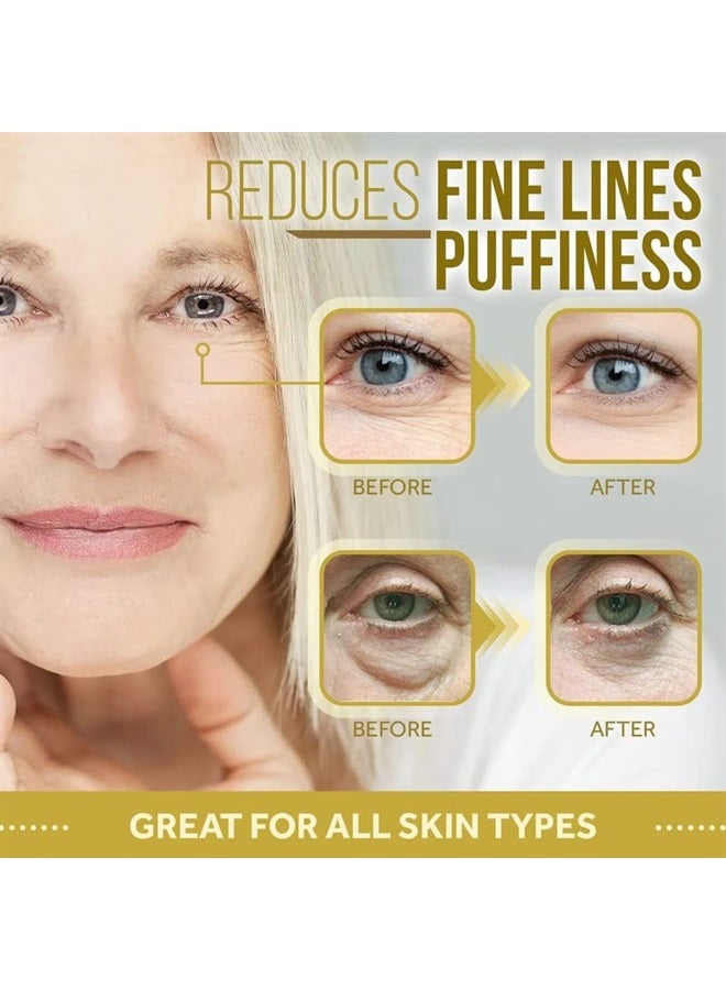 Matykos 24K Gold Under Eye and Forehead Patches - 26 PCS - Collagen and Hyaluronic Acid Pads that Helps Reducing Under Eye Puffiness, Wrinkles, and Dark Circles - NO Artificial Fragrance or Alcohol - Image 4