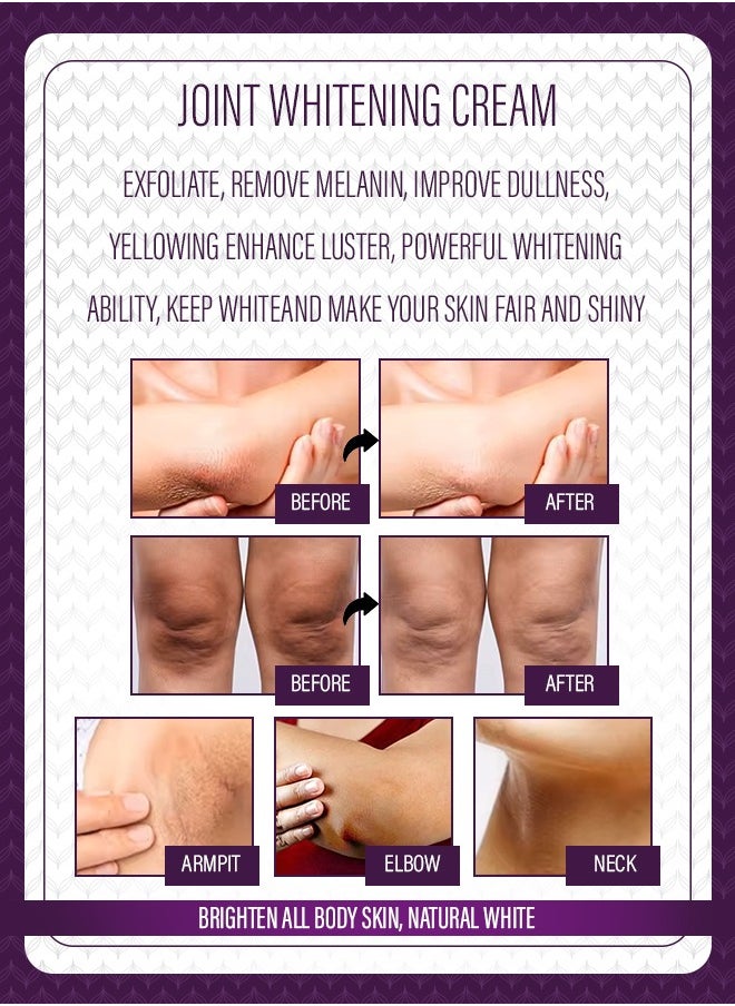 Kanza Dark Knees and Elbows Strong Whitening Cream 120g Get Rid of Knuckles Easily in Just 7 Days Skin Whitening Improve Skin Tone Nourishing and Moisturizing Cream  - Image 5
