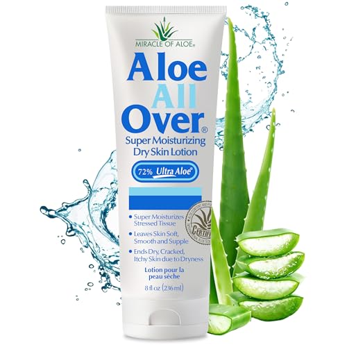 Miracle of Aloe Aloe All Over Super Moisturizing Dry Skin Lotion 8 oz  Made with 72 UltraAloe Aloe Vera Gel Safe for Everyone Men Women Children Kids Restores Dry Skin Fast