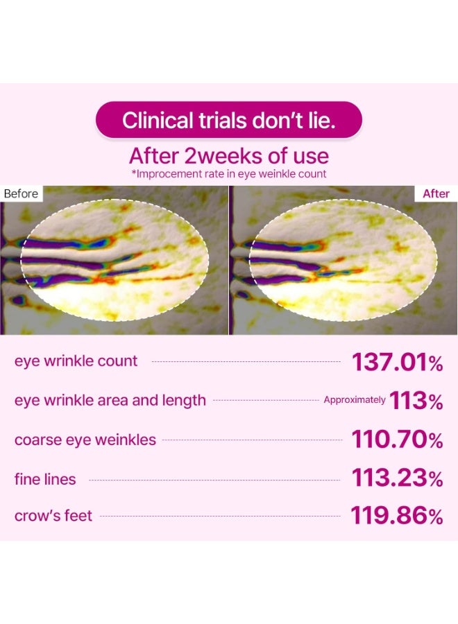 دكتور ميلاكسين لاصقات العين Dr. Melaxin Cemenrete Calcium Volume Eye Patch للبشرة المترهلة تحت العين | عناية بالتجاعيد، الانتفاخ والهالات السوداء | 60 لصقة - Image 2