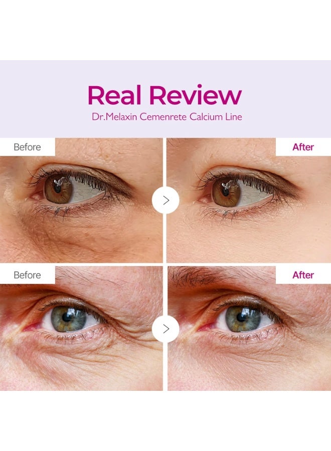 دكتور ميلاكسين لاصقات العين Dr. Melaxin Cemenrete Calcium Volume Eye Patch للبشرة المترهلة تحت العين | عناية بالتجاعيد، الانتفاخ والهالات السوداء | 60 لصقة - Image 3