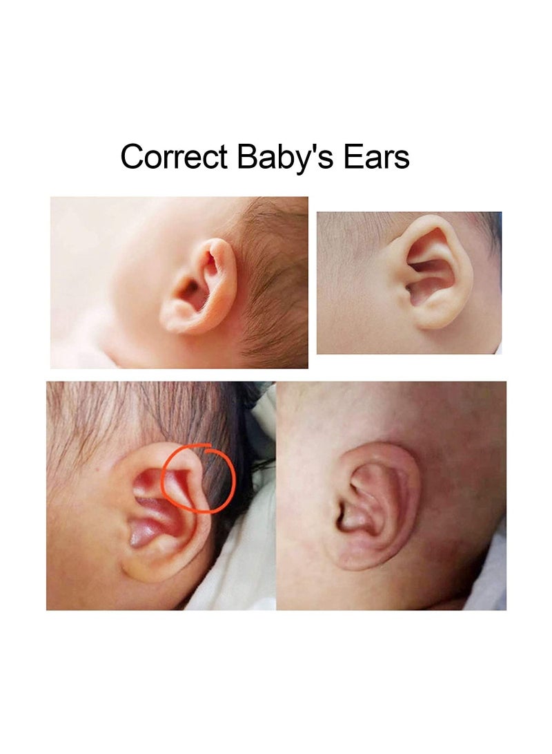 Silicone Newborn Baby Ear Aesthetic Corrector Protruding Patch Sticker 4x50cm - Image 3