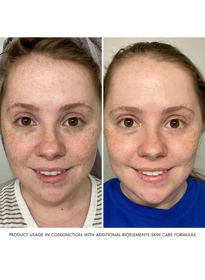 Bioelements بيوايليمنتس بلومب ستارت - 2 أونصة سائلة - سيروم لملء البشرة لتحسين الامتلاء وتنعيم الخطوط الدقيقة - يحتوي على مركب كولاجين-4 - لجميع أنواع البشرة - نباتي، خالي من الغلوتين - لم يتم اختباره على الحيوانات - Image 5