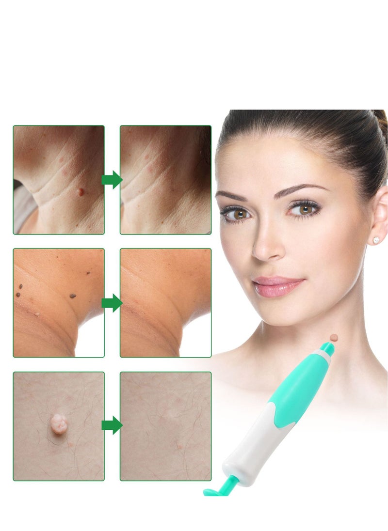 Elaimei - Double Head Wart Removal Tool Skin Tag Removal Blue - Image 1