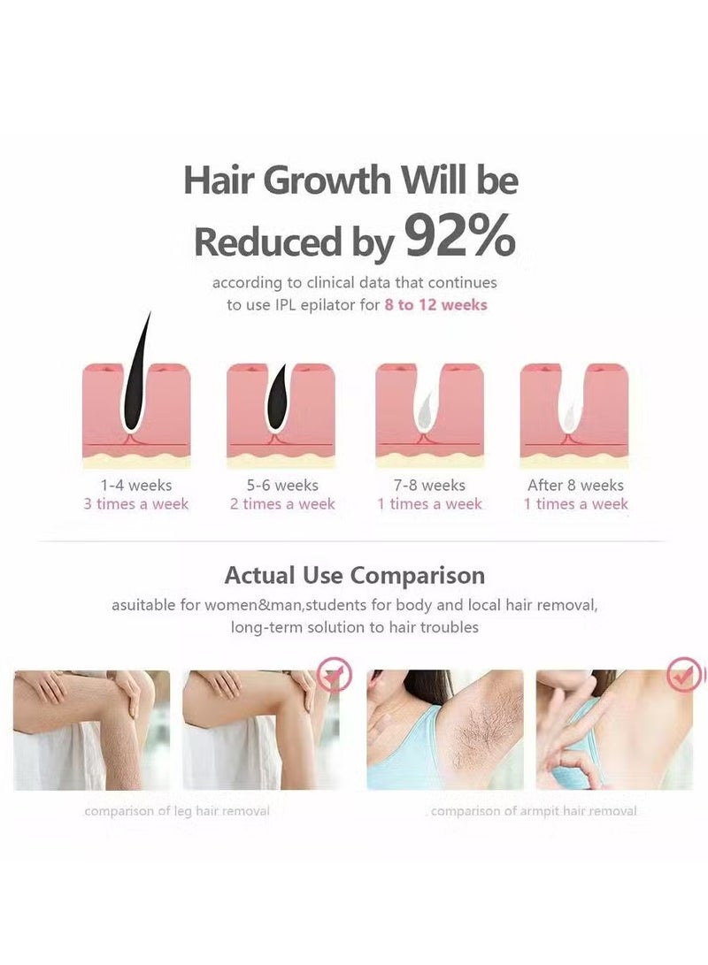 Pulse Laser Hair Removal Device MO-906 – Effortless Hair Removal for Smooth Skin