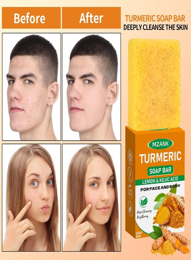 MZANK 2 Pack Kojic Acid Soap,Dark Spot Remover Turmeric Soap Bars Brightening & Moisturizing with Collagen,Vitamin,Hyaluronic Acid,Retinol,Shea Butter,Tumeric Soaps for Face Body All Skin Types - Image 4
