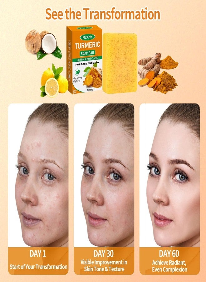 MZANK 2 Pack Kojic Acid Soap,Dark Spot Remover Turmeric Soap Bars Brightening & Moisturizing with Collagen,Vitamin,Hyaluronic Acid,Retinol,Shea Butter,Tumeric Soaps for Face Body All Skin Types - Image 5