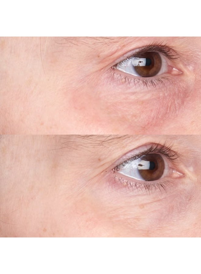 Perricone MD CP+ Daily Defense Moisturiser Broad Spectrum SPF 35 30ml - Image 4