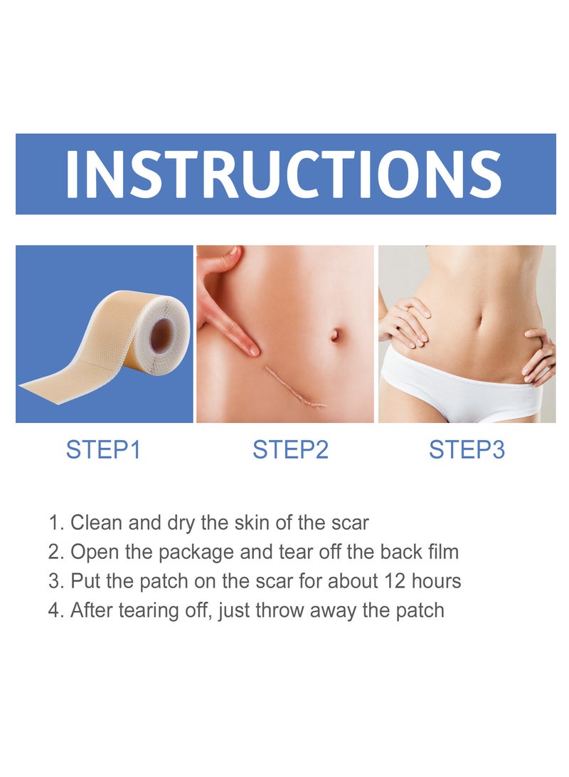 SOUTH MOON 4cm*1.5m Silicone Scar Sheets - Fade Scar Sticker, As Surgical Cream, Gel, Tape, Strips, Patches - Keloid, C-Section, Tummy Tuck - Surgery Scars Removal Treatment - Image 5