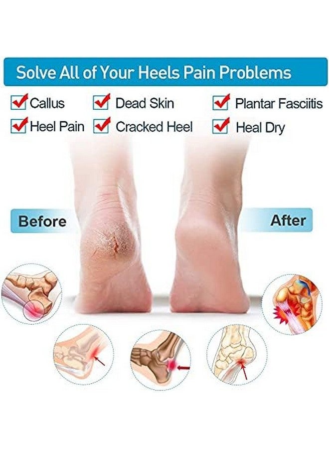 GRAVINO APrime Adda Anti Heel Silicone Heel Anti Crack Vented Moisturizing Silicone Gel Heel Socks for Swelling, Pain Relief, Foot Care Ankle Support Pad Silicon Heel Pad For Men & Women (4 Pair Anti heel) - Image 2