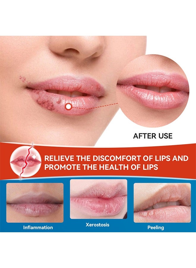 سوميفون Cheilitis Cream-Chinese Herbal Medicine Smooth Lips ، إصلاح الشفاه المتشققة والجافة | مكونات طبيعية للتبريد الفوري وتخفيف الآلام | إزالة الجلد الميت / تلاشي خطوط الشفاه / تحسين لون الشفاه - Image 3