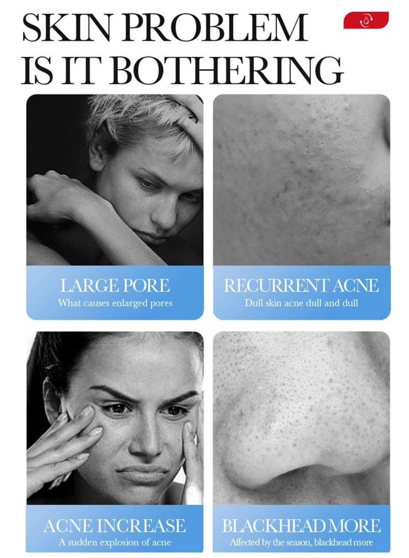 BIOAOUA Acne Spot Treatment Cream with Salicylic Acid, Tightening Pore Facial Cream, 20g - Image 3