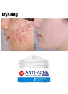 Jaysuing Acne Treatment Face Cream, Acne Spot Treatment for Face and Acne Dots, Natural Cystic Acne Treatment, For All Skin Types, Premium Acne Scar Cream and Pimple Remover, 30ML  - Image 1