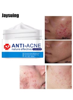 Jaysuing Acne Treatment Face Cream, Acne Spot Treatment for Face and Acne Dots, Natural Cystic Acne Treatment, For All Skin Types, Premium Acne Scar Cream and Pimple Remover, 30ML  - Image 2