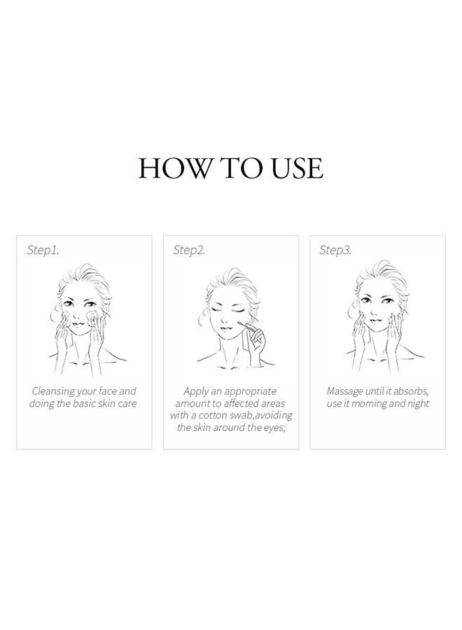 Acne Treatment Face Cream, Acne Spot Treatment for Face and Acne Dots, Natural Cystic Acne Treatment, For All Skin Types, Premium Acne Scar Cream and Pimple Remover, 30ML