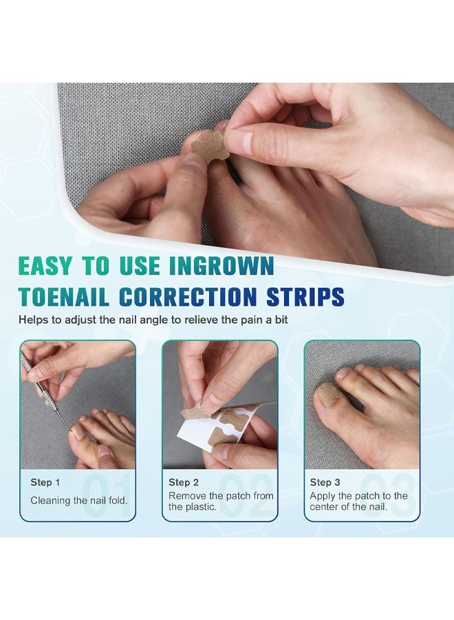 50 PCS Breathable Ingrown Toenail Corrector Patch with Double-Ended Stainless Steel Toenail Lifter – Comprehensive Toenail Care Solution - Image 3