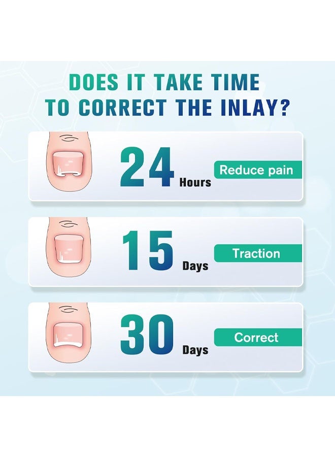 50 PCS Breathable Ingrown Toenail Corrector Patch with Double-Ended Stainless Steel Toenail Lifter – Comprehensive Toenail Care Solution - Image 5