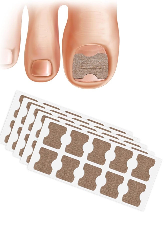 50 PCS Breathable Ingrown Toenail Corrector Patch with Double-Ended Stainless Steel Toenail Lifter – Comprehensive Toenail Care Solution - Image 1