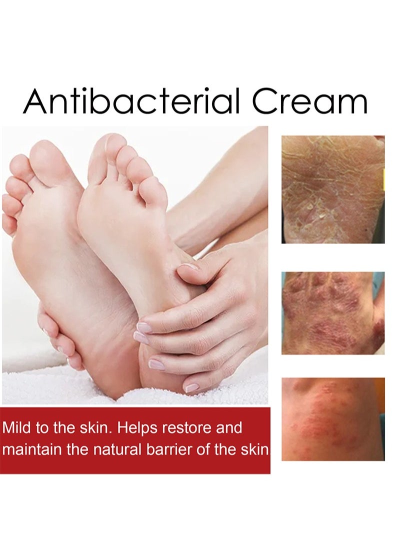 SOUTH MOON - Psoriasis Relief Cream with 0.35% Chlorhexidine Acetate, Herbal Formula Antibacterial Cream Full Body Psoriasis Moisturizer Natural Repair Antibacterial Soothing Exfoliating Rough Skin Care - Image 1