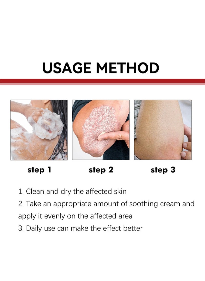 SOUTH MOON - Psoriasis Relief Cream with 0.35% Chlorhexidine Acetate, Herbal Formula Antibacterial Cream Full Body Psoriasis Moisturizer Natural Repair Antibacterial Soothing Exfoliating Rough Skin Care - Image 1