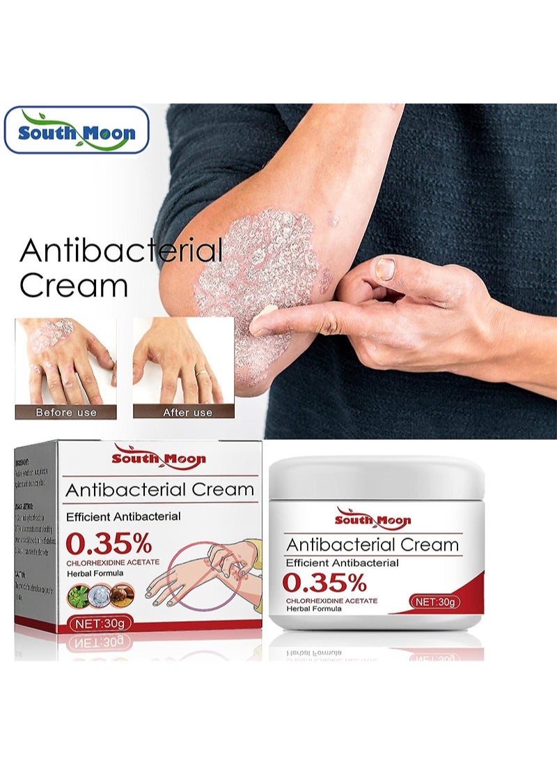 SOUTH MOON - Psoriasis Relief Cream with 0.35% Chlorhexidine Acetate, Herbal Formula Antibacterial Cream Full Body Psoriasis Moisturizer Natural Repair Antibacterial Soothing Exfoliating Rough Skin Care - Image 1