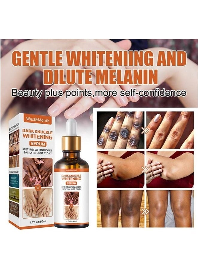West&Month Whitening Serum Hand Knuckle Glow Serum, Restoring Hand Treatment, Moisturizing, Exfoliates and Reduces Unbalanced Pigmentation, for Removing Dark Knuckle Elbow, Brighter, Firmer Skin - Image 4