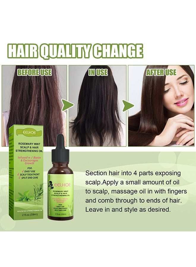 EELHOE Rosemary Mint Scalp Hair Strengthening Oil, For Hair Growth Hair Care, For Split End Care, Nourishes Scalp, Rid Of Itchy And Dry Scalp, Hair Loss - Image 4