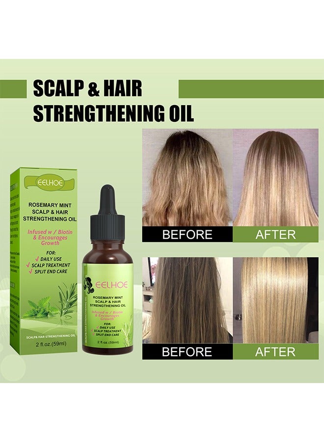 EELHOE Rosemary Mint Scalp Hair Strengthening Oil, For Hair Growth Hair Care, For Split End Care, Nourishes Scalp, Rid Of Itchy And Dry Scalp, Hair Loss - Image 5