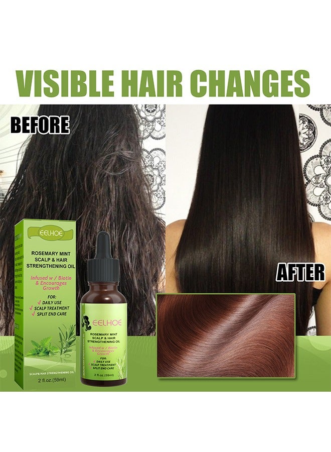 EELHOE Rosemary Mint Scalp Hair Strengthening Oil, For Hair Growth Hair Care, For Split End Care, Nourishes Scalp, Rid Of Itchy And Dry Scalp, Hair Loss - Image 3