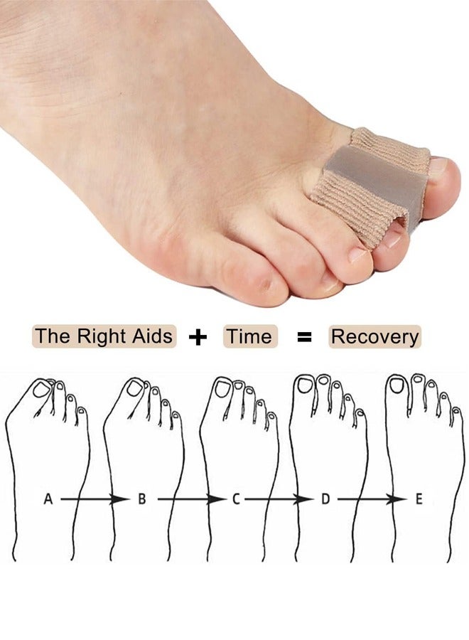 2Pcs Gel Toe Separators, Overlapping Bunion Corrector, Silicone Toe Separators with Soft Gel Pad Pain Relief Bunion Bunion Corrector, Nylon Silicone, One Size - Image 2